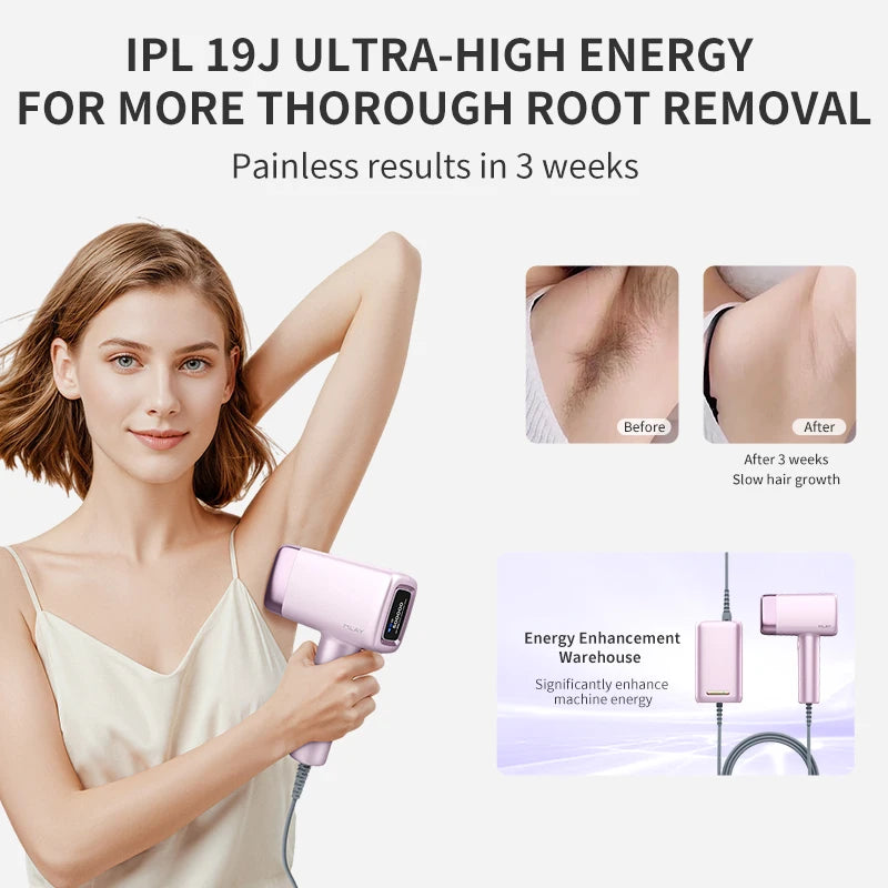 MLAY T14 IPL Laser Epilator For Home Hair Removal Face Body Bikini Painless 5 Levels CE RoHS 500000 Shots