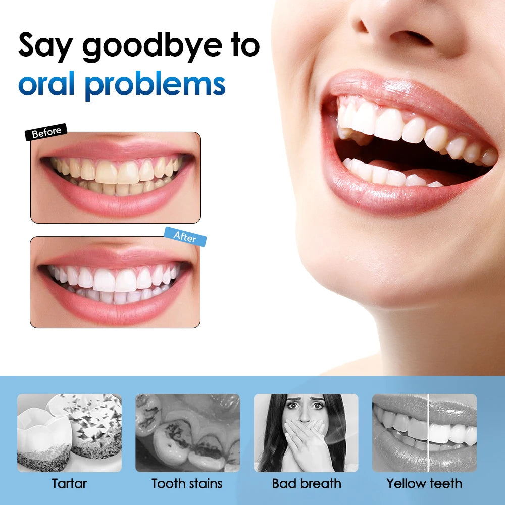 AFDEAL Electric Sonic Toothbrush For Plaque And Coffee Stain Removal