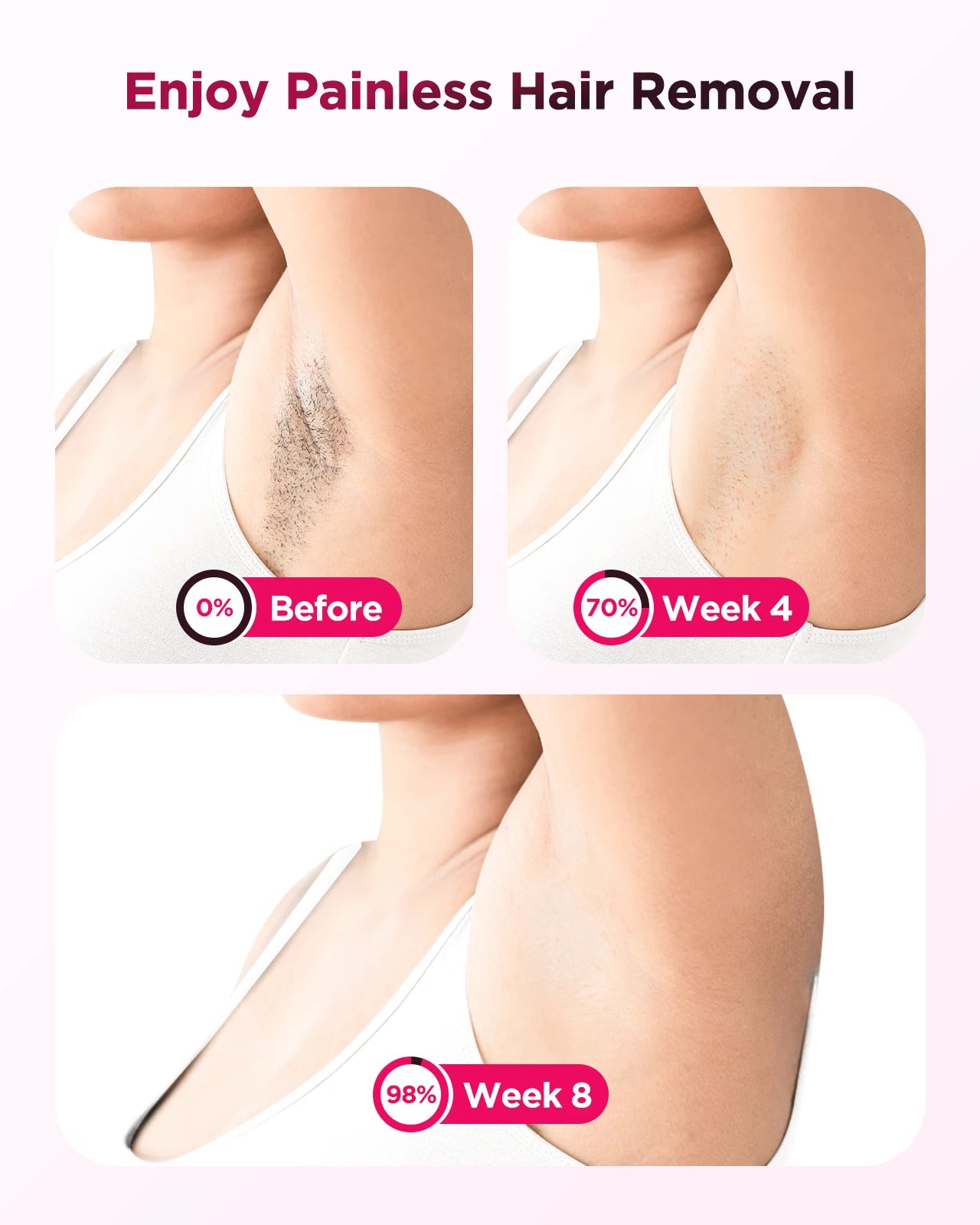 Totmizby Flash Laser Epilator IPL Hair Removal For Body Facial